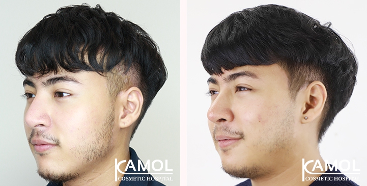 lg-6494958e0b5fc-image