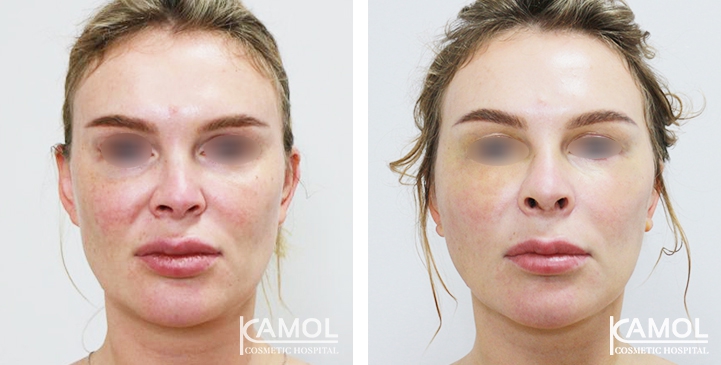 lg-6494958e437a1-image