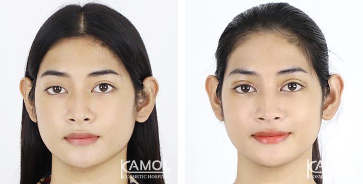 lg-6494958e8dced-image