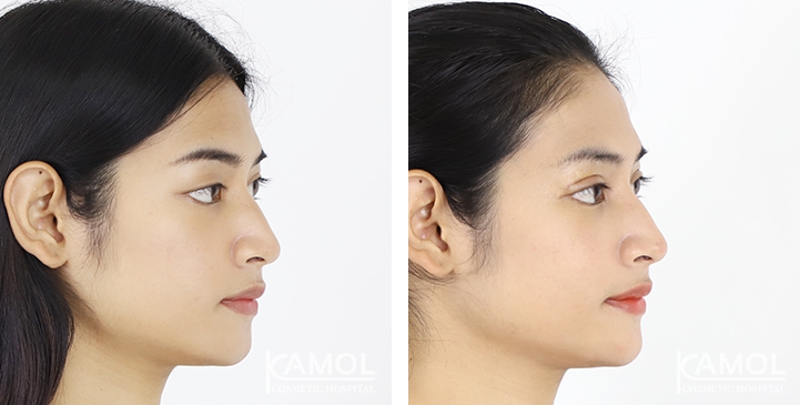 lg-6494958e91e7e-image