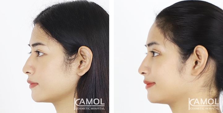 lg-6494958e95db2-image