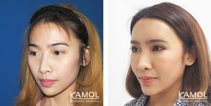 lg-6494958e9af2e-image