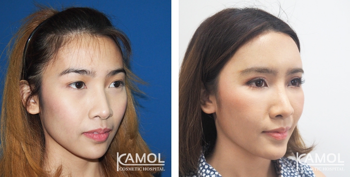 lg-6494958e9cffd-image