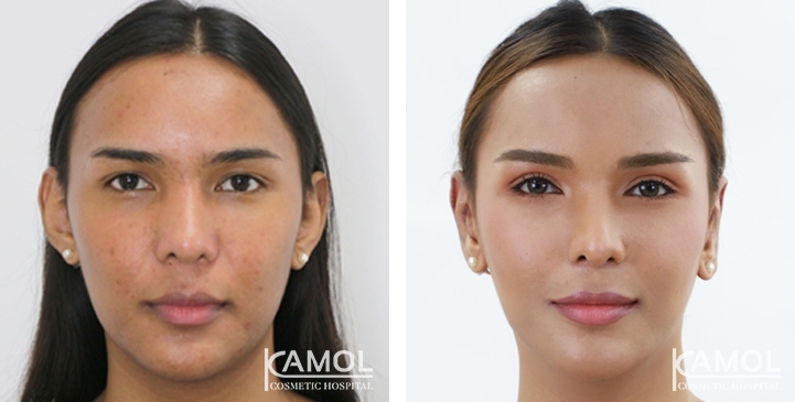 lg-6494958e9fcb0-image