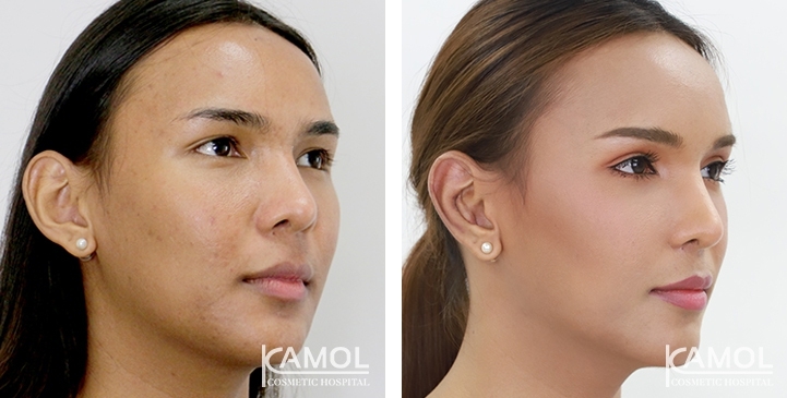 lg-6494958ea1c8d-image