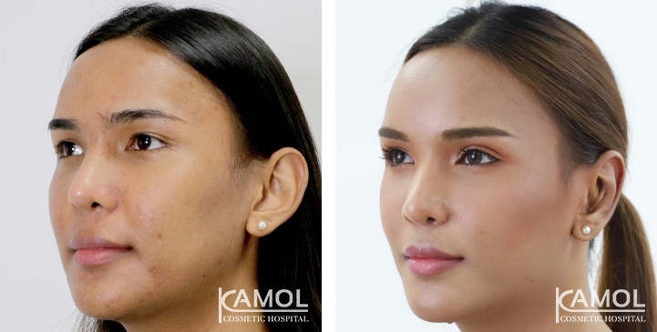 lg-6494958ea3d02-image