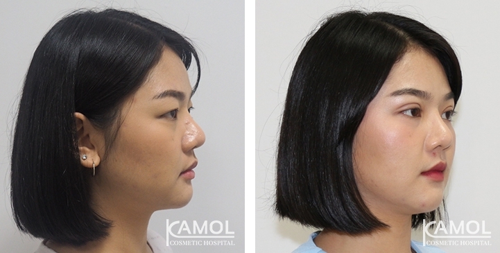 lg-6494958ea8d23-image