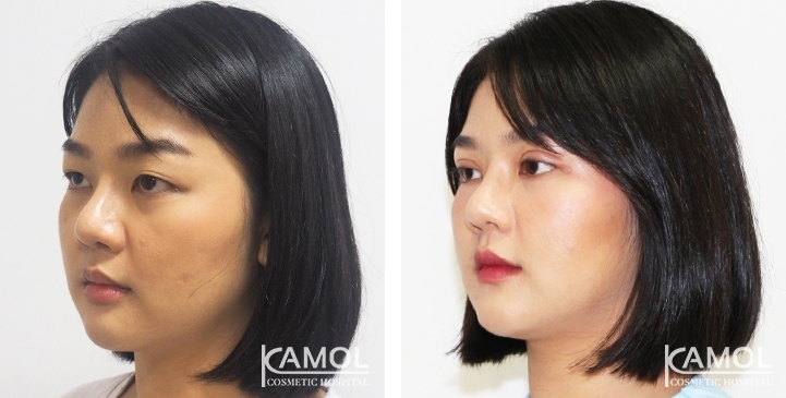 lg-6494958eaadb6-image