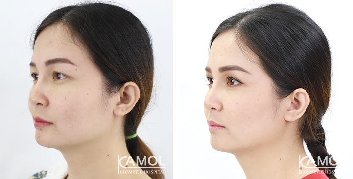 lg-6494958eaff05-image