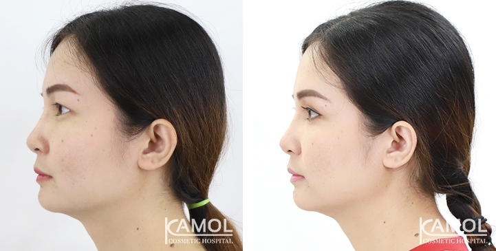 lg-6494958eb1ef8-image