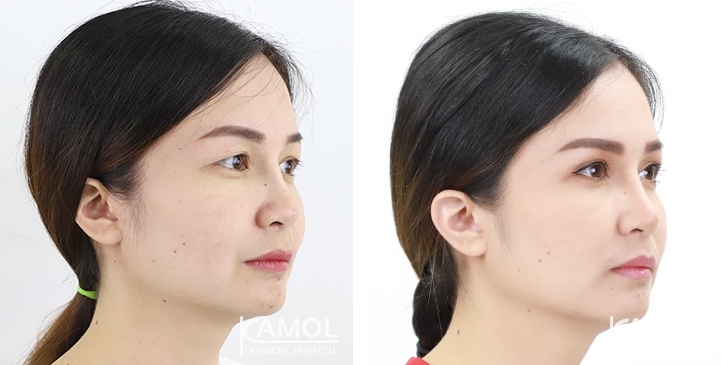 lg-6494958eb3ed9-image