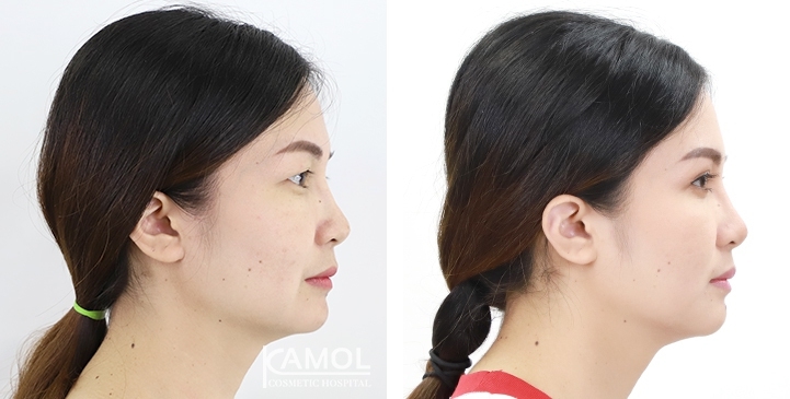 lg-6494958eb60e7-image