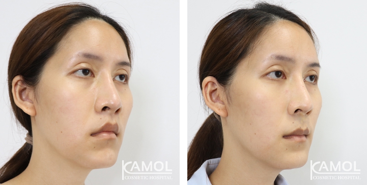 lg-6494958ebad76-image