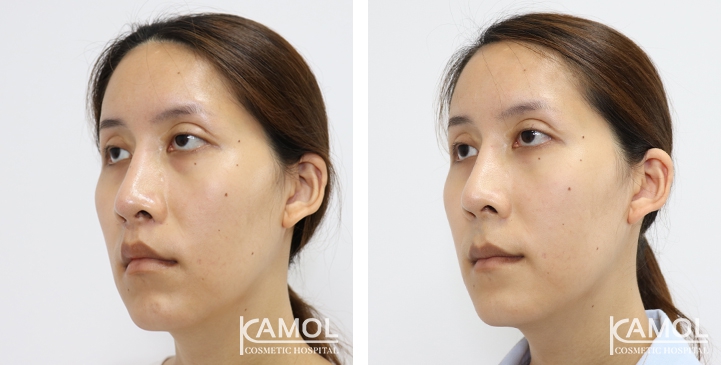 lg-6494958ebcb0d-image