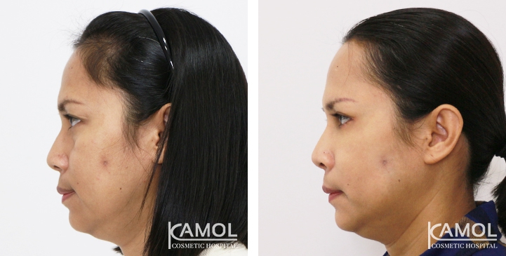 lg-6494958ed5106-image