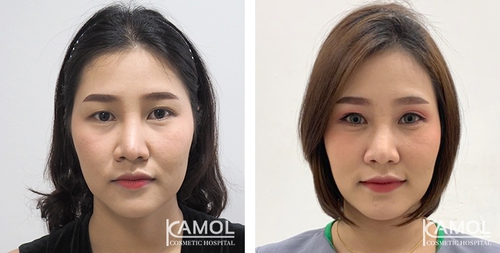 lg-6494958ede53a-image