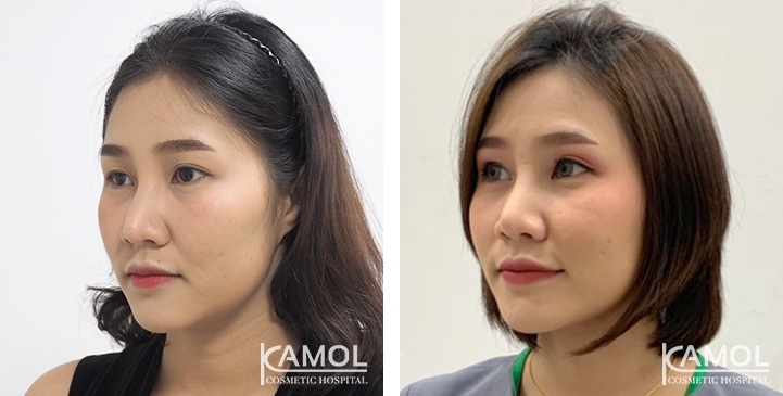 lg-6494958ee0583-image