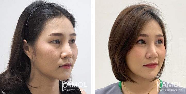 lg-6494958ee2361-image