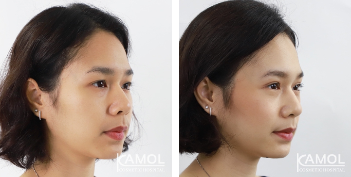 lg-6494958ee6d3c-image