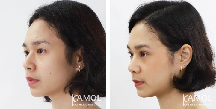 lg-6494958ee8d4f-image