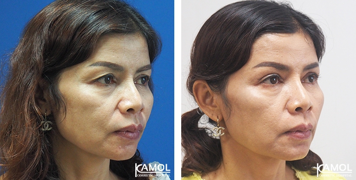 lg-6494958eed578-image