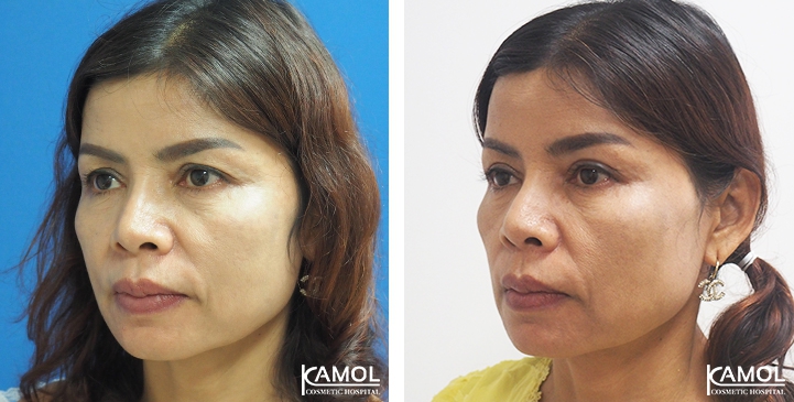 lg-6494958eef5d0-image