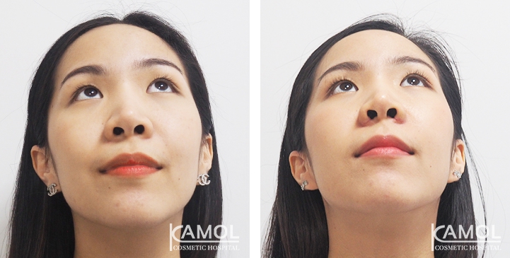 lg-6494958ef3fec-image