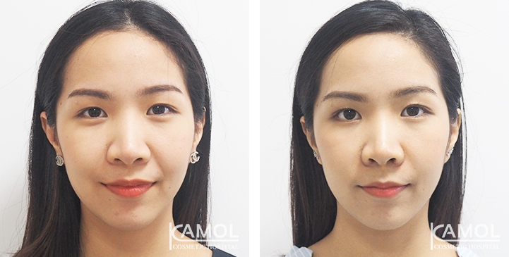 lg-6494958f02196-image