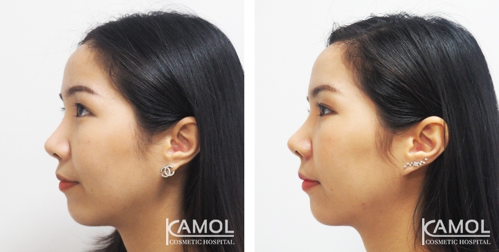 lg-6494958f0490b-image