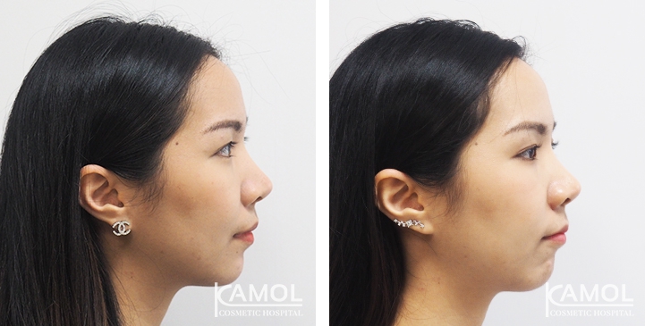 lg-6494958f06e79-image