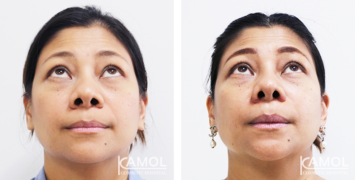 lg-6494958f09d7e-image