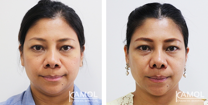 lg-6494958f0bed1-image