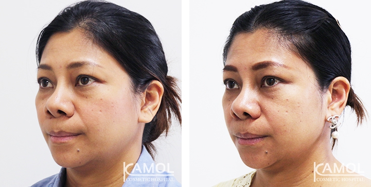 lg-6494958f0e07d-image