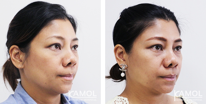 lg-6494958f1225d-image