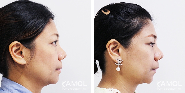 lg-6494958f143e3-image