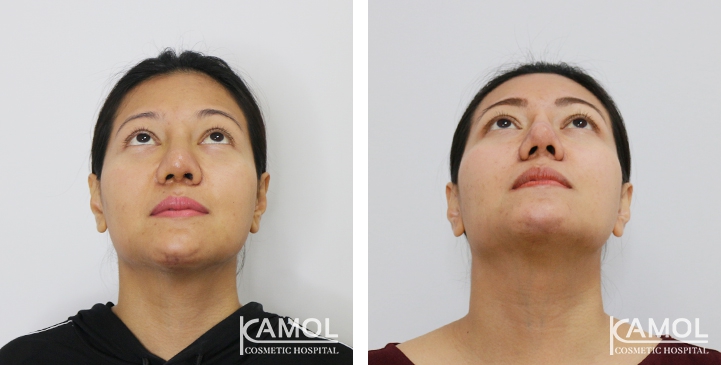 lg-6494958f16e7d-image