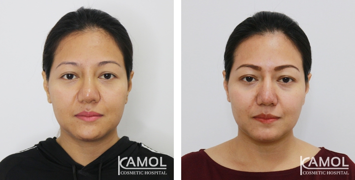 lg-6494958f18ca5-image