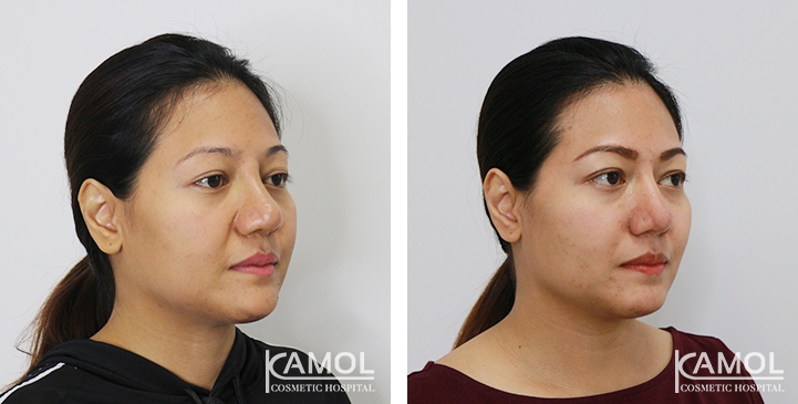 lg-6494958f1eefe-image