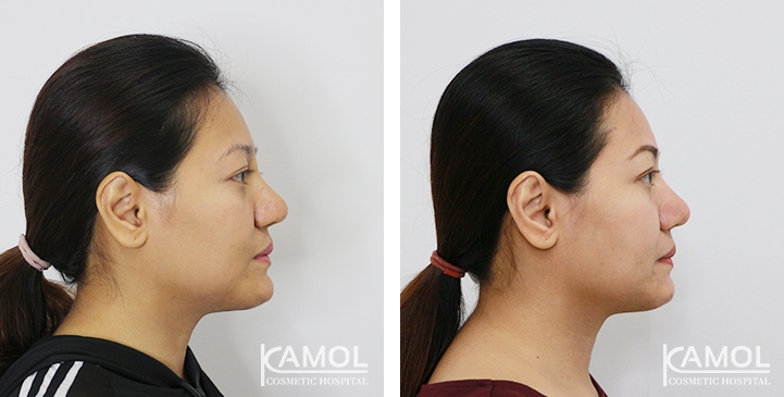 lg-6494958f20ec7-image