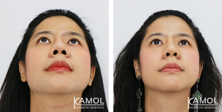 lg-6494958f23af8-image