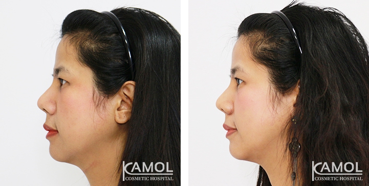 lg-6494958f29a79-image