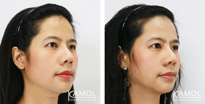 lg-6494958f2b988-image