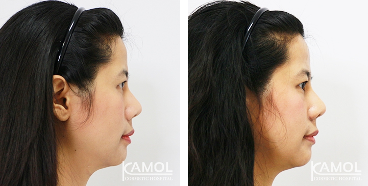 lg-6494958f2eb4d-image