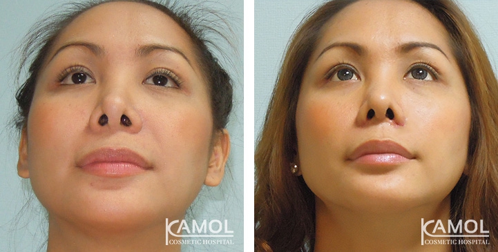 lg-6494958f3b40a-image