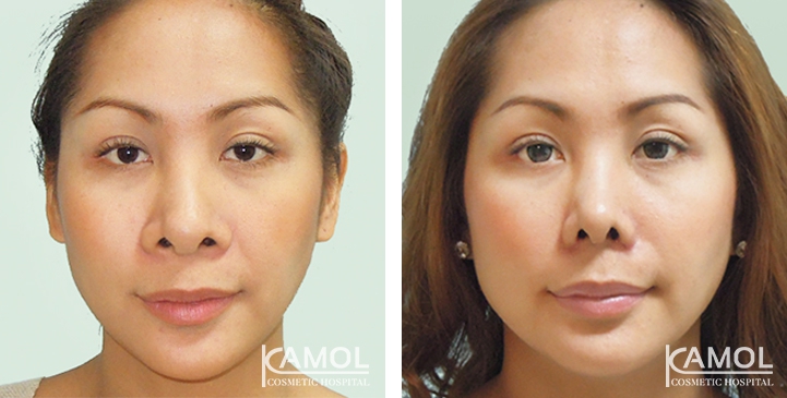 lg-6494958f3d2b6-image