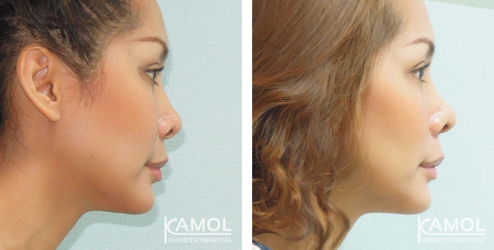 lg-6494958f3f263-image