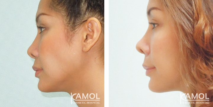 lg-6494958f41275-image