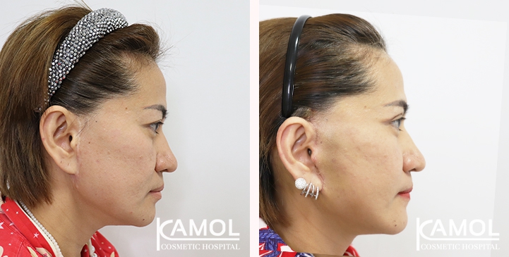 lg-6494958f4ac99-image