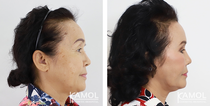 lg-6494958f794b0-image