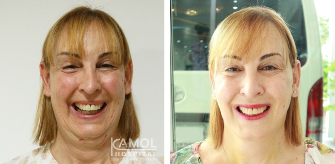 lg-6494958f7be6b-image